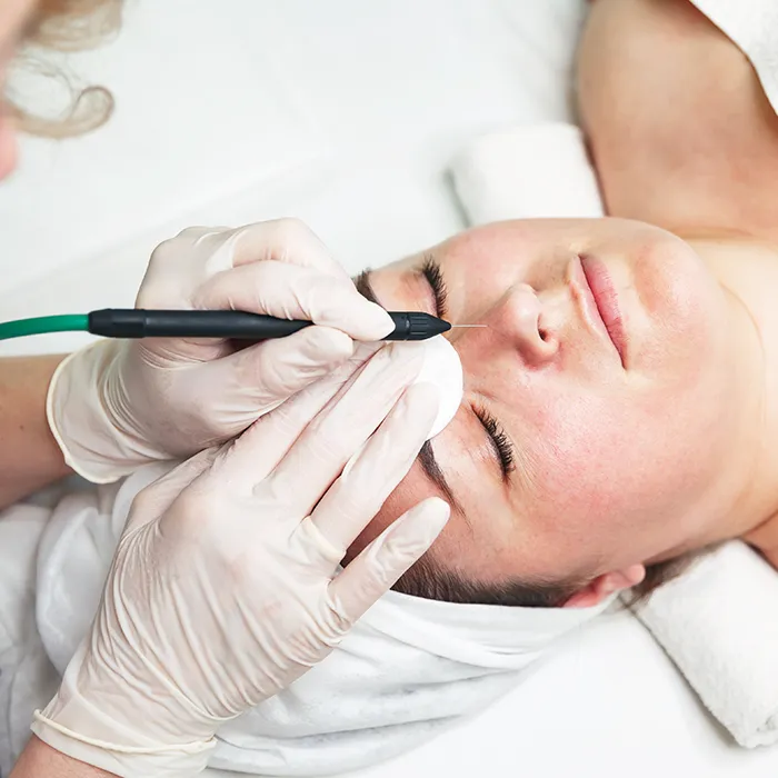 Elektrokoagulacja Nowy Sącz